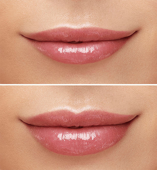 Lips before and after